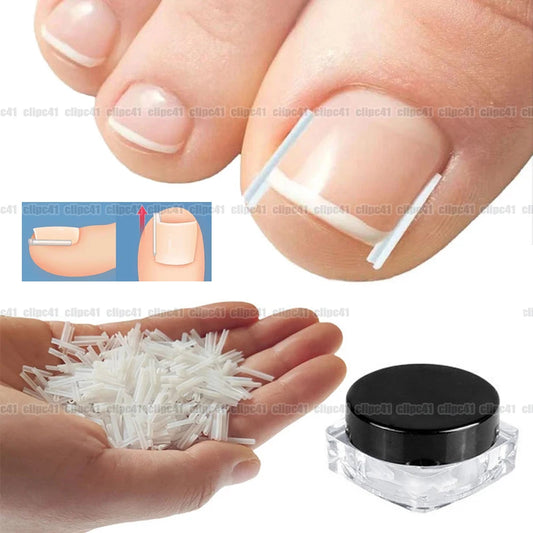 Correcteur d’Ongle Incarné – Patch Élastique Discret