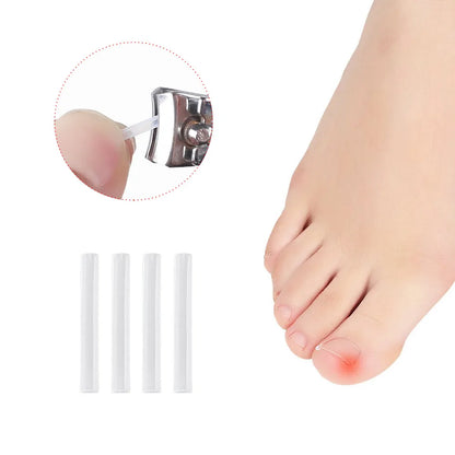 Correcteur d’Ongle Incarné – Patch Élastique Discret